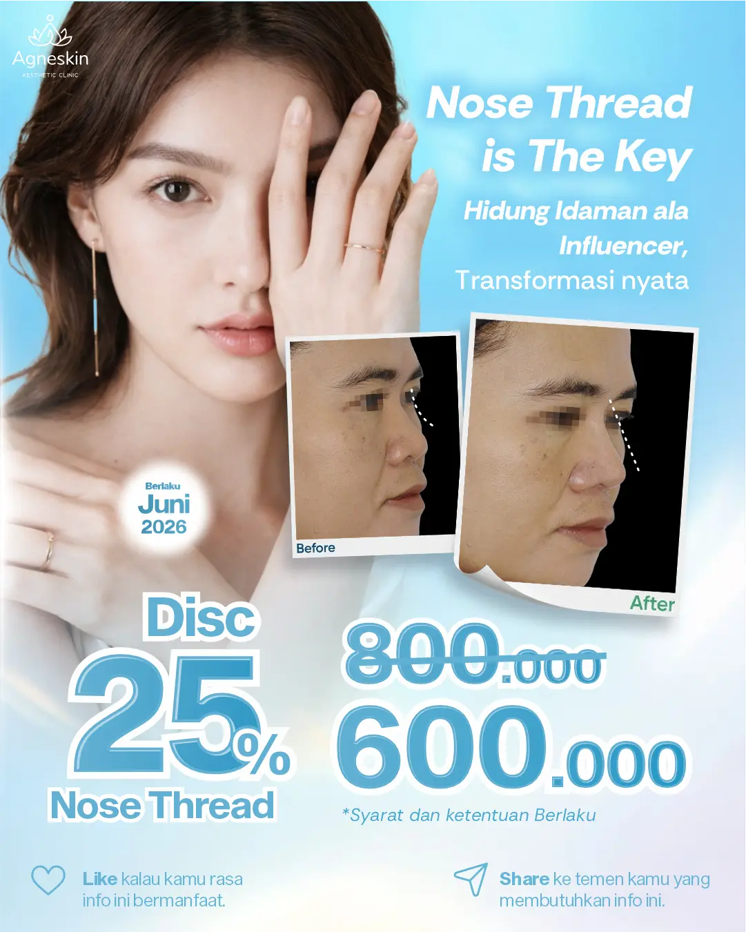 Promo Nose Thread Juni 2026